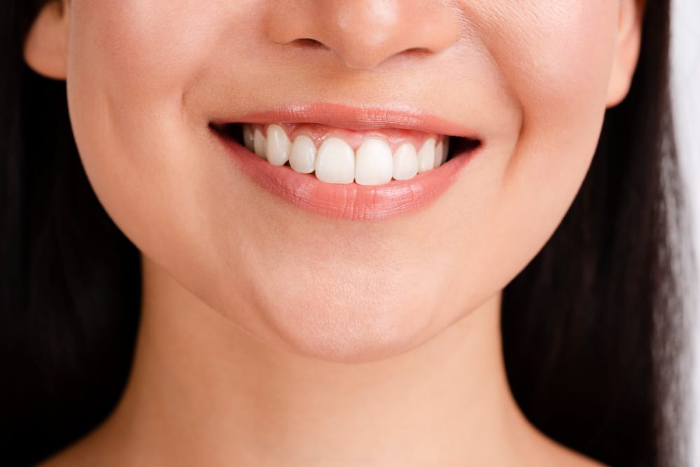 Close-up of a woman smiling, showing her clean and white teeth.